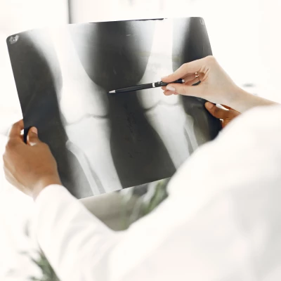 Lekarz trzymający w ręku zdjęcie rentgenowskie